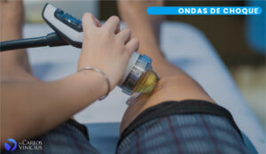 ondas de choque