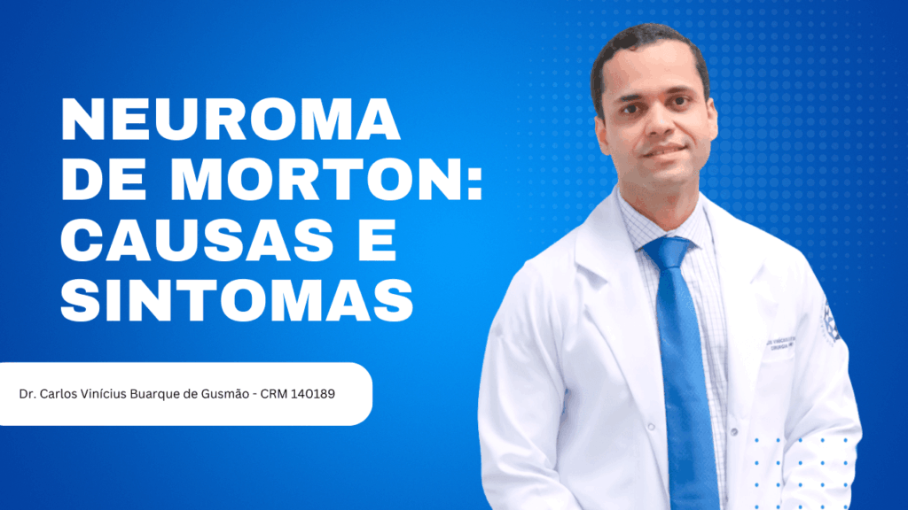 Neuroma de Morton