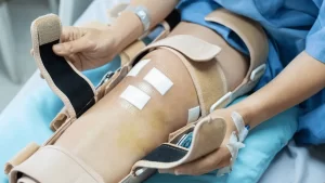 cirurgia-de-lca-e-tranquila