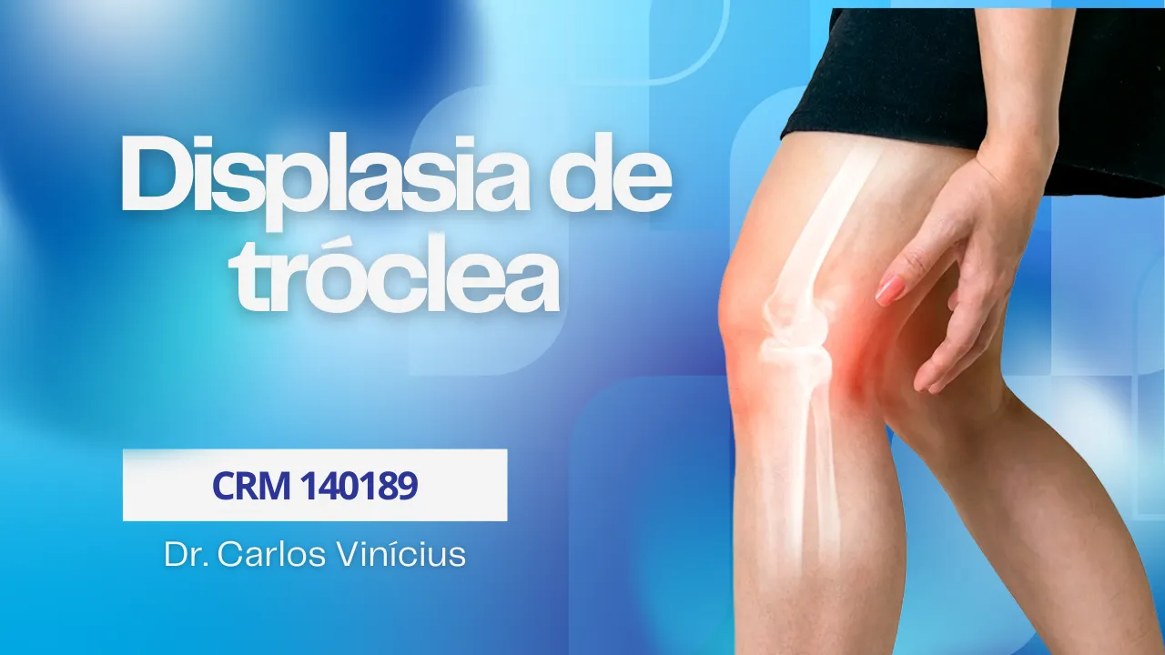 displasia-de-troclea