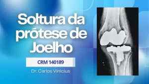 soltura-da-protese-de-joelho