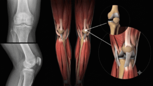 anatomia-do-joelho