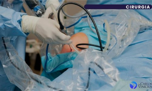 membrana de colágeno