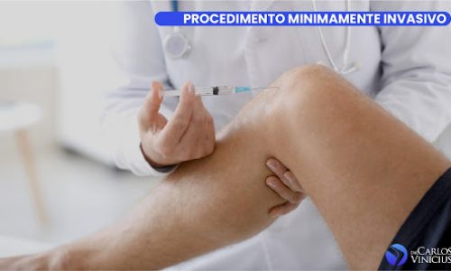 Infiltração joelho