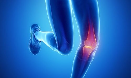 ruptura do ligamento cruzado anterior