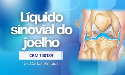 Liquido sinovial do joelho
