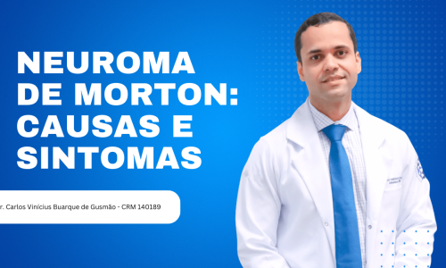 Neuroma de Morton