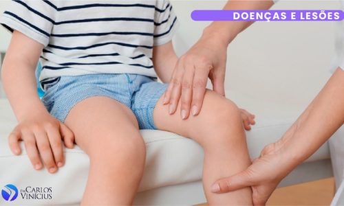 osteocondrite dissecante