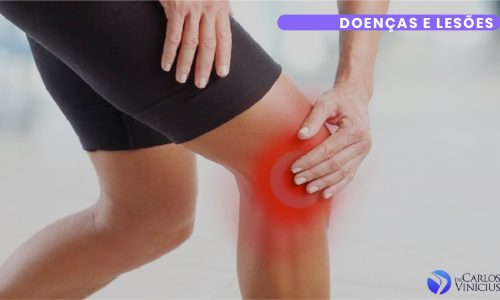 ligamento cruzado anterior
