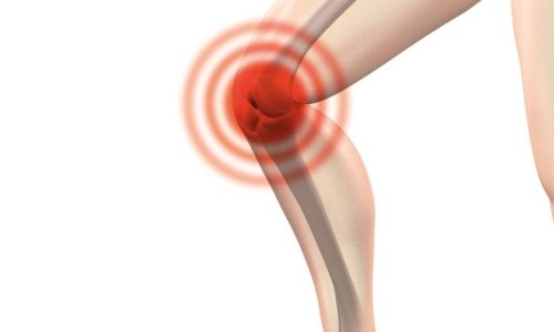 prótese no joelho