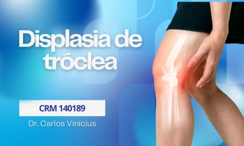 displasia-de-troclea