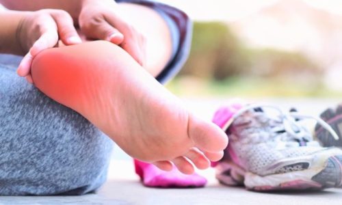 fasciíte plantar