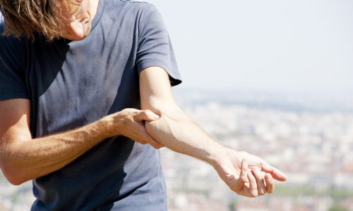 Uma pessoa do sexo masculino, sentindo dor típica no lado medial do seu cotovelo, também conhecida como "Epicondilite Medial" (Cotovelo de Golfista).