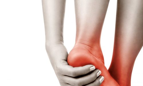 fasciíte plantar